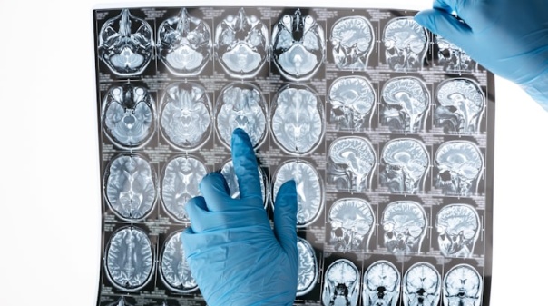 Estudo revela que «pico da atividade cerebral não ocorre na juventude»