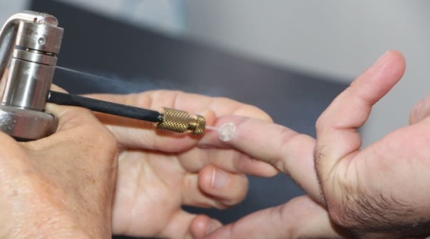 Alcoutim recebe rastreio gratuito do cancro e outras doen&ccedil;as de pele