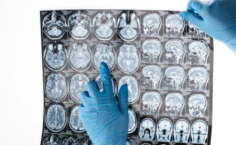 Estudo revela que «pico da atividade cerebral não ocorre na juventude»