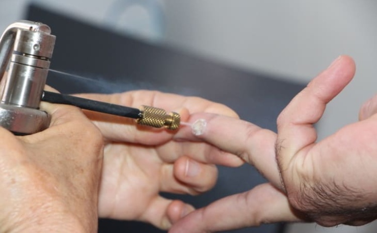 Alcoutim recebe rastreio gratuito do cancro e outras doen&ccedil;as de pele